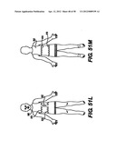 Obstructive Sleep Apnea Treatment Devices, Systems and Methods diagram and image