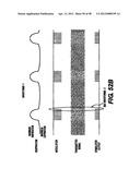 Obstructive Sleep Apnea Treatment Devices, Systems and Methods diagram and image