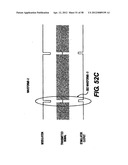 Obstructive Sleep Apnea Treatment Devices, Systems and Methods diagram and image