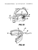 Obstructive Sleep Apnea Treatment Devices, Systems and Methods diagram and image