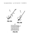 Obstructive Sleep Apnea Treatment Devices, Systems and Methods diagram and image