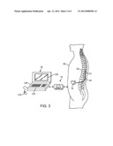 NEUROSTIMULATION SYSTEM AND METHOD FOR PROVIDING THERAPY TO PATIENT WITH     MINIMAL SIDE EFFECTS diagram and image