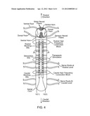 NEUROSTIMULATION SYSTEM AND METHOD FOR PROVIDING THERAPY TO PATIENT WITH     MINIMAL SIDE EFFECTS diagram and image