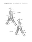 MICROCATHETER diagram and image