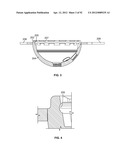 IMPLANT COMPONENTS AND METHODS diagram and image