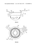 IMPLANT COMPONENTS AND METHODS diagram and image