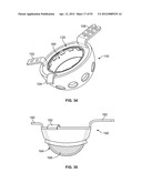 IMPLANT COMPONENTS AND METHODS diagram and image