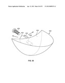 IMPLANT COMPONENTS AND METHODS diagram and image