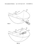 IMPLANT COMPONENTS AND METHODS diagram and image