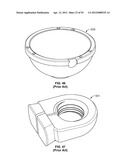 IMPLANT COMPONENTS AND METHODS diagram and image