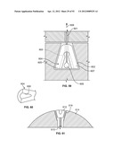 IMPLANT COMPONENTS AND METHODS diagram and image