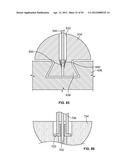 IMPLANT COMPONENTS AND METHODS diagram and image