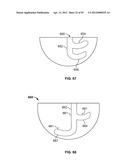 IMPLANT COMPONENTS AND METHODS diagram and image