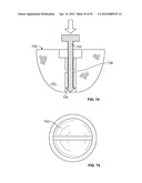 IMPLANT COMPONENTS AND METHODS diagram and image