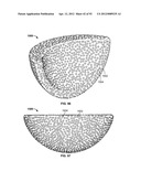 IMPLANT COMPONENTS AND METHODS diagram and image