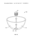 IMPLANT COMPONENTS AND METHODS diagram and image