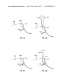 IMPLANT COMPONENTS AND METHODS diagram and image