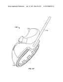 IMPLANT COMPONENTS AND METHODS diagram and image