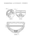 IMPLANT COMPONENTS AND METHODS diagram and image