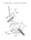 IMPLANT COMPONENTS AND METHODS diagram and image