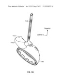 IMPLANT COMPONENTS AND METHODS diagram and image