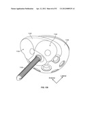 IMPLANT COMPONENTS AND METHODS diagram and image