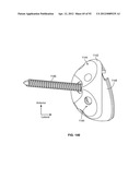 IMPLANT COMPONENTS AND METHODS diagram and image