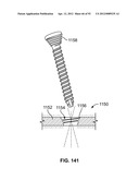 IMPLANT COMPONENTS AND METHODS diagram and image