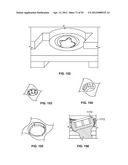 IMPLANT COMPONENTS AND METHODS diagram and image