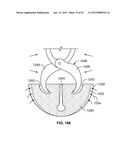 IMPLANT COMPONENTS AND METHODS diagram and image