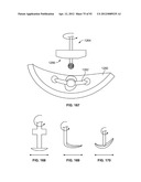 IMPLANT COMPONENTS AND METHODS diagram and image