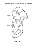 IMPLANT COMPONENTS AND METHODS diagram and image