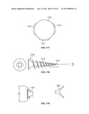 IMPLANT COMPONENTS AND METHODS diagram and image