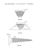 IMPLANT COMPONENTS AND METHODS diagram and image