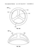 IMPLANT COMPONENTS AND METHODS diagram and image