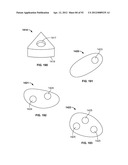 IMPLANT COMPONENTS AND METHODS diagram and image