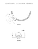 IMPLANT COMPONENTS AND METHODS diagram and image