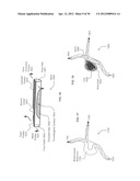 Specialty Stents with flow control features or the like diagram and image