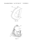 FULL-FACE MASK AND MASK CUSHION THEREFOR diagram and image