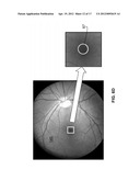 HANDHELD REFLECTOMETER FOR MEASURING MACULAR PIGMENT diagram and image