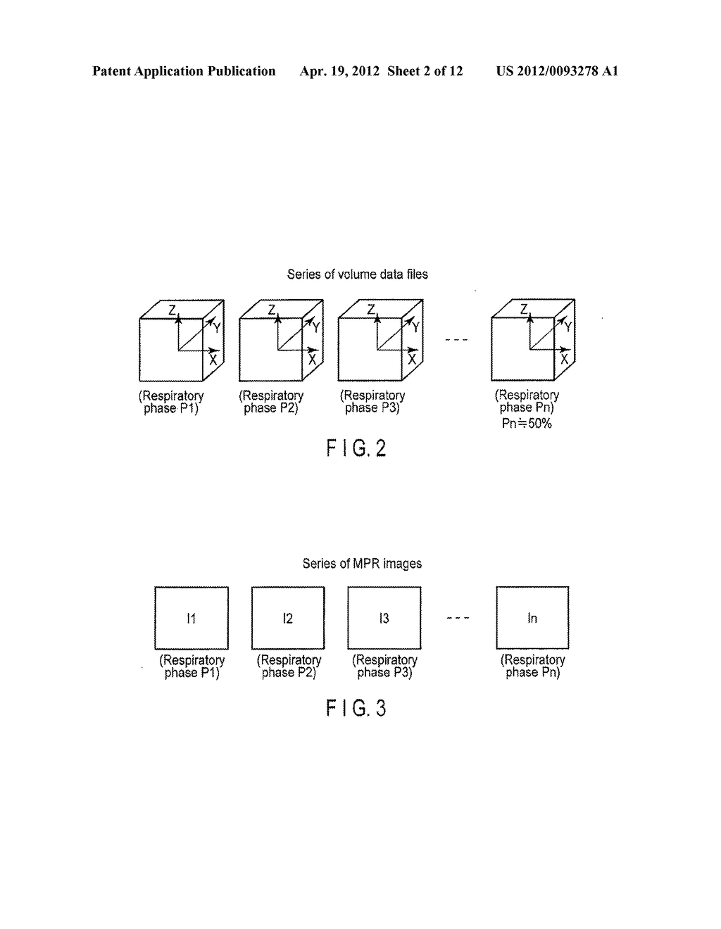 MEDICAL IMAGE PROCESSING APPARATUS AND X-RAY COMPUTED TOMOGRAPHY APPARATUS - diagram, schematic, and image 03