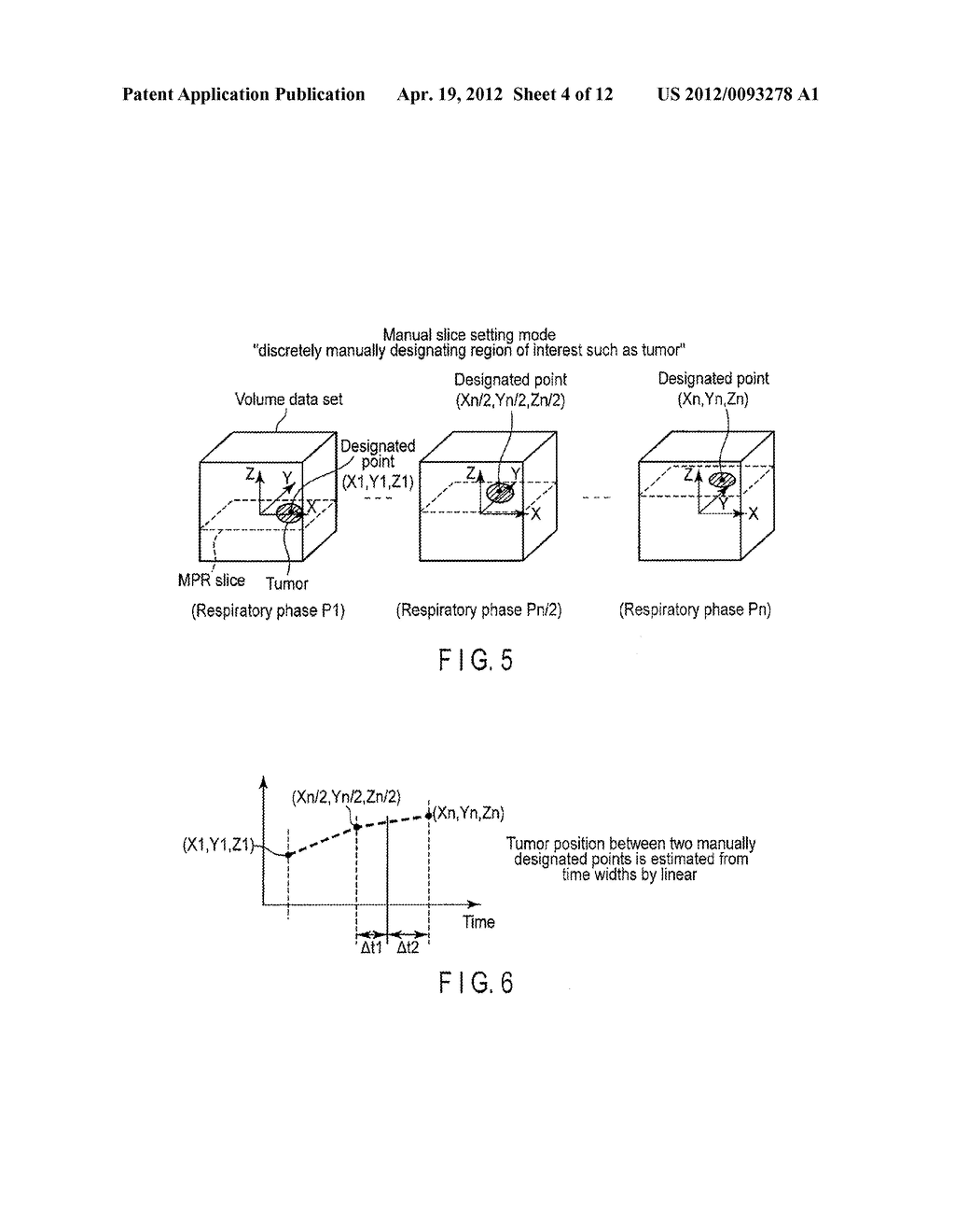 MEDICAL IMAGE PROCESSING APPARATUS AND X-RAY COMPUTED TOMOGRAPHY APPARATUS - diagram, schematic, and image 05