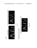 MEDICAL IMAGE PROCESSING APPARATUS AND X-RAY COMPUTED TOMOGRAPHY APPARATUS diagram and image