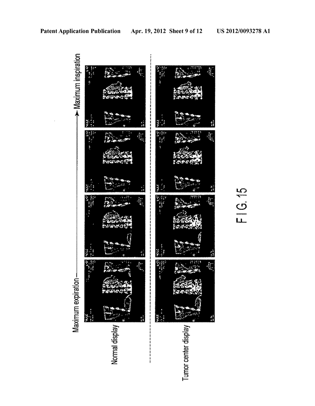 MEDICAL IMAGE PROCESSING APPARATUS AND X-RAY COMPUTED TOMOGRAPHY APPARATUS - diagram, schematic, and image 10