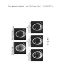 MEDICAL IMAGE PROCESSING APPARATUS, X-RAY COMPUTED TOMOGRAPHY APPARATUS,     AND MEDICAL IMAGE PROCESSING METHOD diagram and image