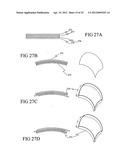 DELIVERY SYSTEM FOR RADIATION THERAPY diagram and image