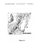 Method of Treating Degenerative Disorders of the Nervous System diagram and image