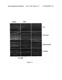 Inhibition of Neovascularization by Cerium Oxide Nanoparticles diagram and image