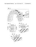 METHOD AND APPARATUS FOR INDIRECT BONDING OF ORTHODONTIC APPLIANCES TO     TEETH diagram and image