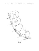 Coordinated Metal And Ceramic Orthodontic Bracket Systems diagram and image